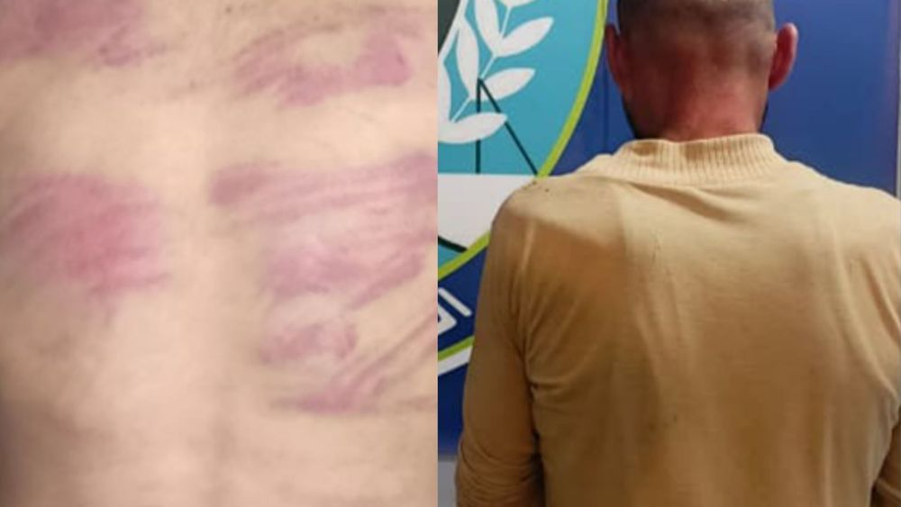 بالصور - ربط ابنته بالشجرة وعذبها وأخيها بأبشع الطرق.. متوحّش في بعبدا!