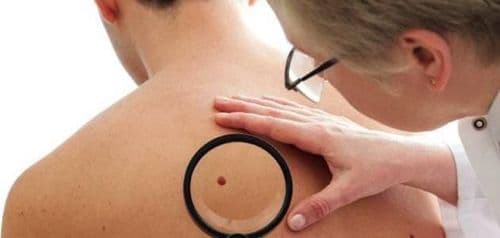 أعراض عادية قد تكون مؤشر مبكر لمرض خبيث.. لا تتجاهلها!