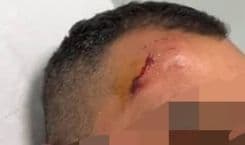 3 جرحى في البقاع.. والسبب الانتخابات